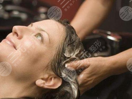 頭皮屑多頭皮癢掉頭發(fā)該怎么治?