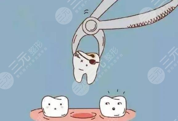 補(bǔ)牙多少錢一顆牙?能報(bào)銷嗎