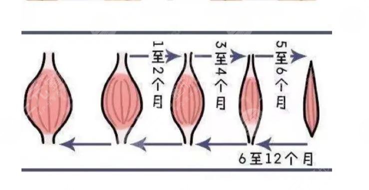 有什么危害和副作用?打在哪里?