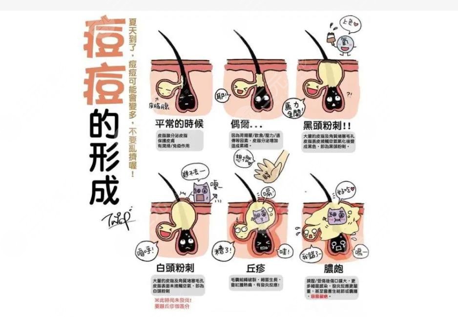 后背長痘痘是什么原因?