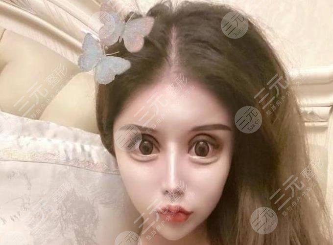 13歲開始整容女現(xiàn)狀如何?1