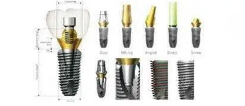 韓國奧齒泰種植體