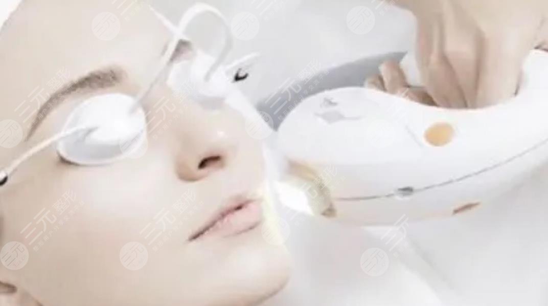 光電美膚手術(shù)