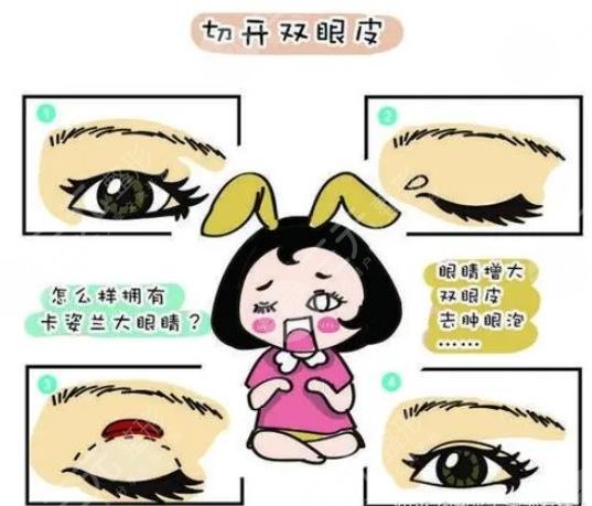 女子割雙眼皮死亡后續(xù)