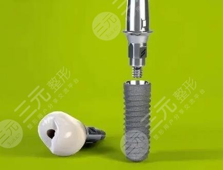 做種植牙的第一步：術(shù)前準(zhǔn)備