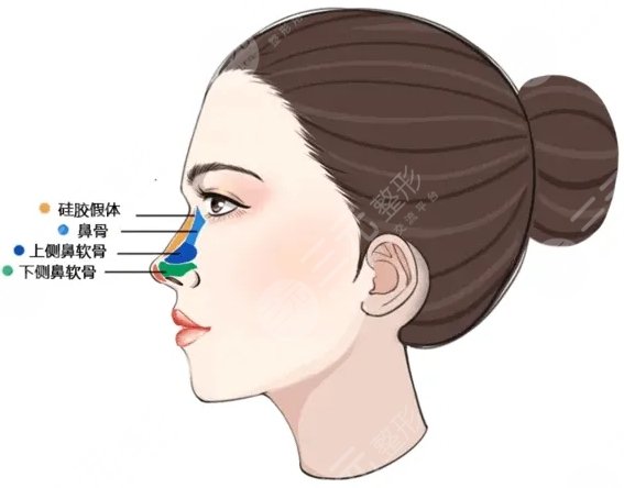 十個(gè)做鼻子九個(gè)后悔真的嗎