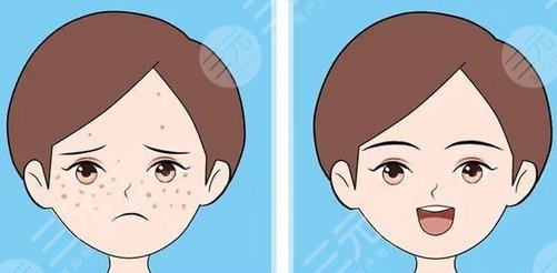 濟(jì)寧市第一人民醫(yī)院光子嫩膚怎么樣