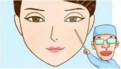 無(wú)錫二院割雙眼皮技術(shù)怎么樣？精選案例分享&去的人都這樣說(shuō)！附價(jià)格表參考哦~