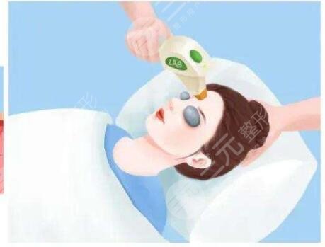 光子嫩膚手術