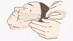 泰安中心醫(yī)院吳軍成拉皮手術(shù)怎么樣？術(shù)后案例分析&設(shè)備齊全、技術(shù)嫻熟