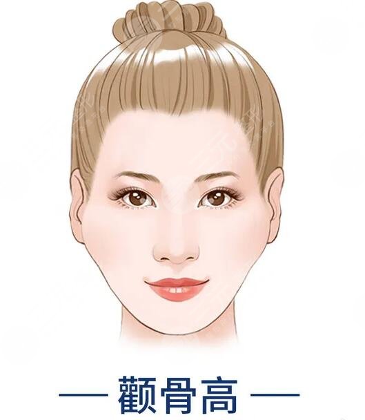 磨顴骨前后對比圖驚掉網(wǎng)友下巴！術(shù)后告別兇巴巴的氣場，秒變甜美萌妹~