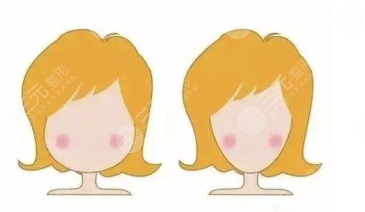 進(jìn)行下顎骨手術(shù)的注意事項