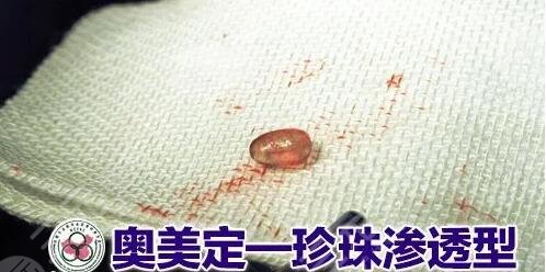 奧美定取出價格大概需要多少