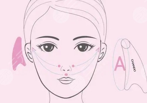 v-line瓜子臉手術(shù)注意事項