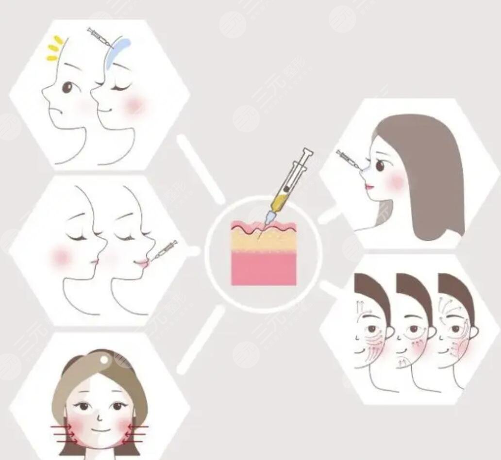 *玻尿酸注射后如何養(yǎng)護(hù)皮膚果維持時(shí)間長？