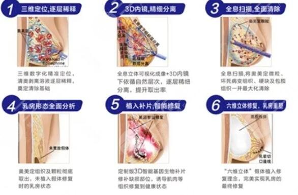 去奧美定選擇的醫(yī)院不同價(jià)格也就不同