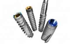 全口種植需要多少種植體？牙齒種植必看科普！附價(jià)格&醫(yī)院3家介紹~