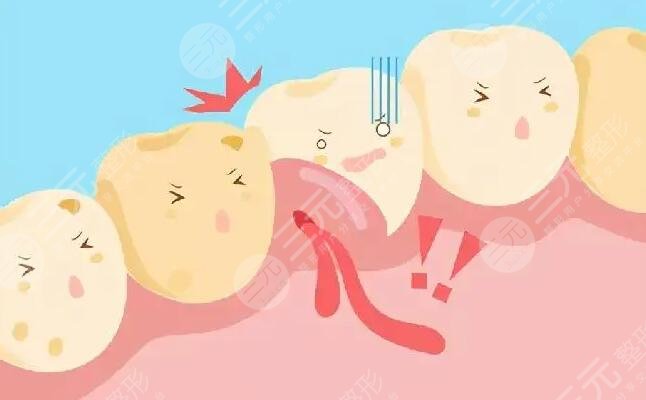 健康牙齦的顏色是什么顏色的？白色更健康是真的嗎？事實會突破你的認知~