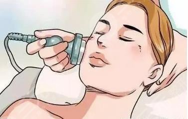 河北省二院點陣激光案例分享