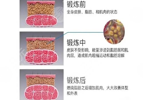 美修斯減肥有用嗎?