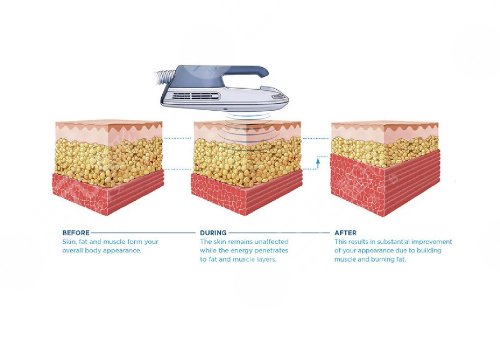 美修斯減肥有用嗎?