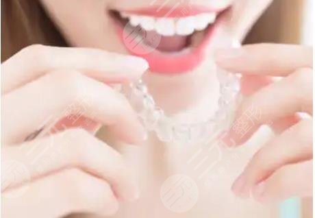 牙齒矯正案例分享