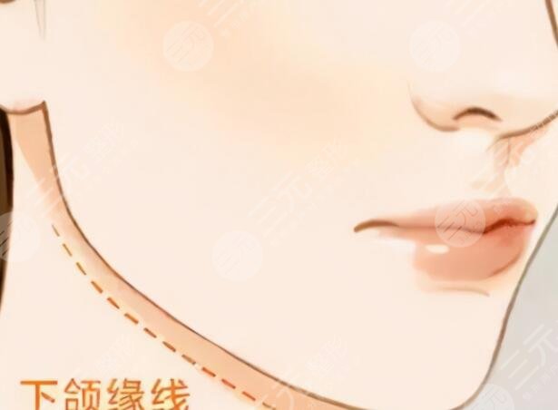 削骨手術(shù)前后對比圖