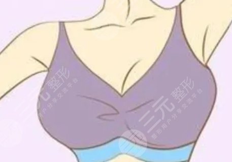 豐胸產(chǎn)品真的有用嗎