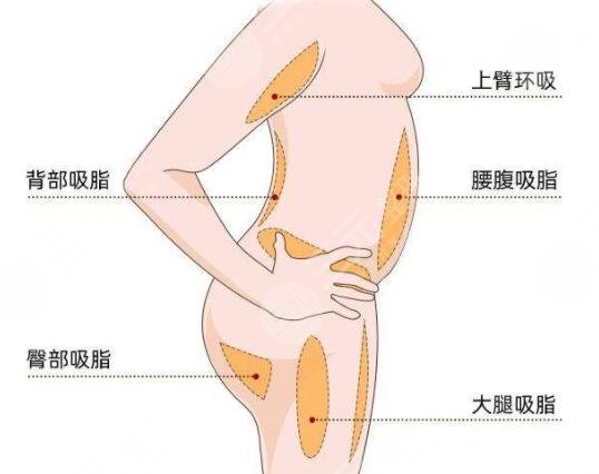 光纖溶脂瘦大腿術(shù)后注意事項(xiàng)