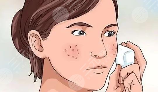 激光緩解毛孔粗大價(jià)格是多少