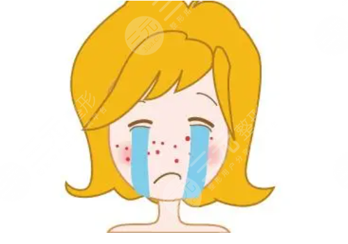 e光祛痘多少錢一次？