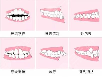 梅州人民醫(yī)院熱門項目