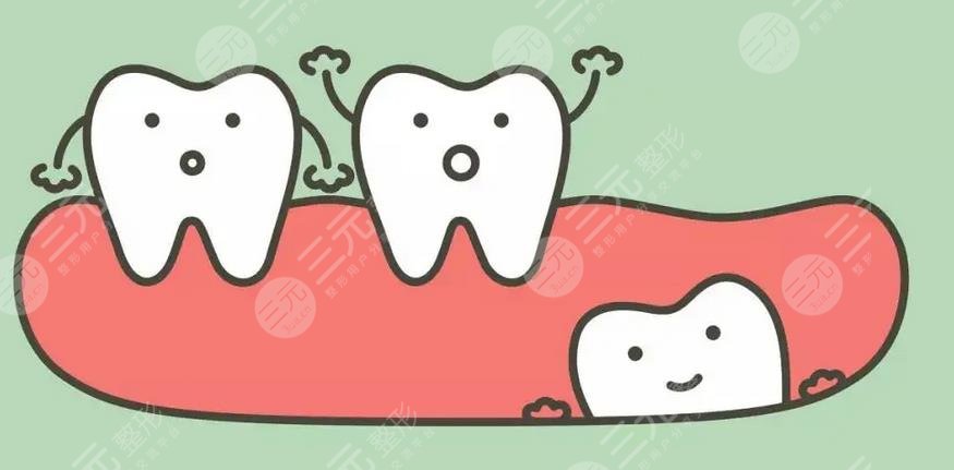 拔智齒幾天才能恢復(fù)正?常?