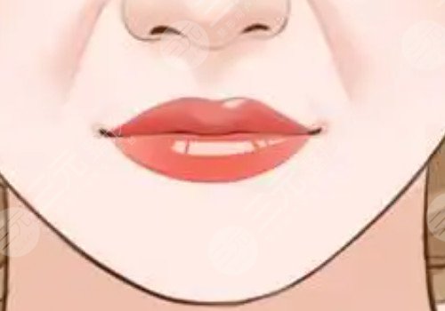 厚嘴唇怎么變??？
