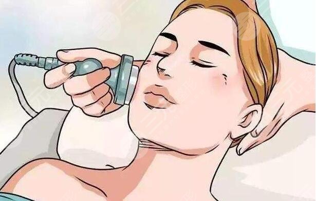 激光美白注意事項(xiàng)有那些?