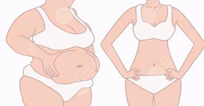 如何減肥不反彈而且果快？