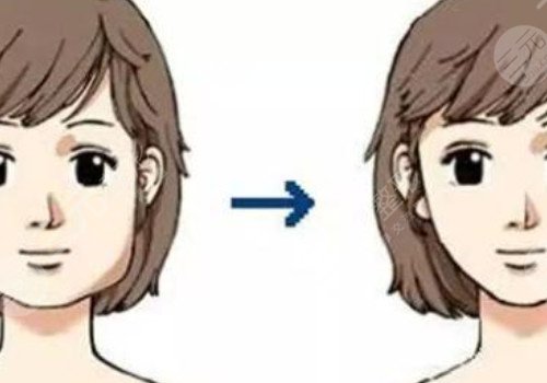 咬肌發(fā)達怎么瘦下來?