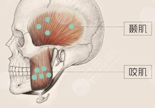 咬肌發(fā)達怎么瘦下來?
