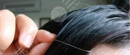 長白頭發(fā)了是什么原因導致的?