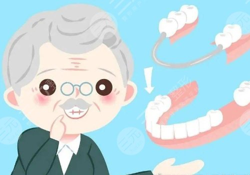 一般假牙價格多少?