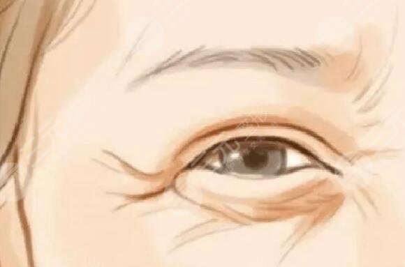 去皺果好的眼霜有哪些比較好？盤點祛皺果好的科學(xué)方法有幾種？