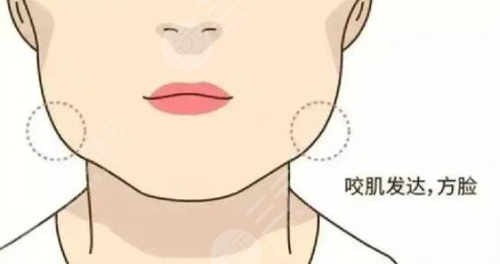 咬肌怎么變小快速的方法不動刀！照搬文中的方法可以讓你更快的變小臉~