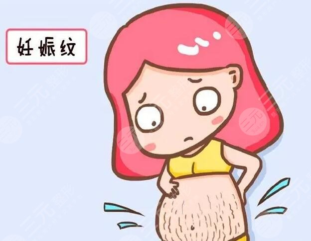 祛除妊娠紋的有方法