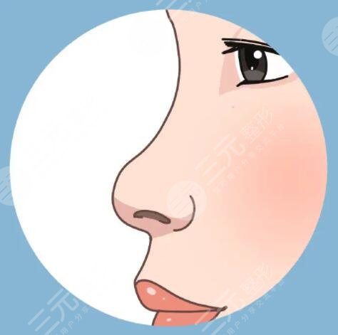 注射隆鼻需要注意什么問題？術后如何飲食？如何保護鼻子？一一幫你解惑~