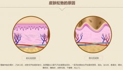 皮膚怎樣補水？5種方式分享，水靈美肌的養(yǎng)成秘籍，必看！