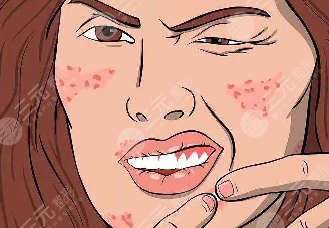 怎樣消除紅腫的痘痘更有？這幾種方法好用又操作簡單！果是肉眼可見的！