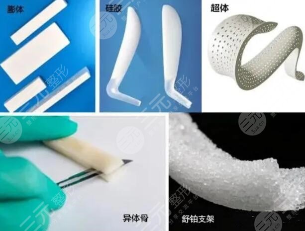 做個鼻梁需要多少錢費(fèi)用？