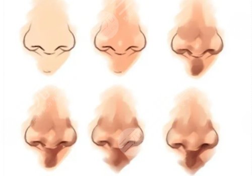 鼻頭鼻翼縮小多少錢?