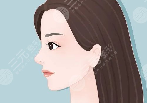 鼻頭鼻翼縮小影響因素介紹