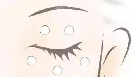 眼睛周圍長(zhǎng)脂肪粒怎么辦?